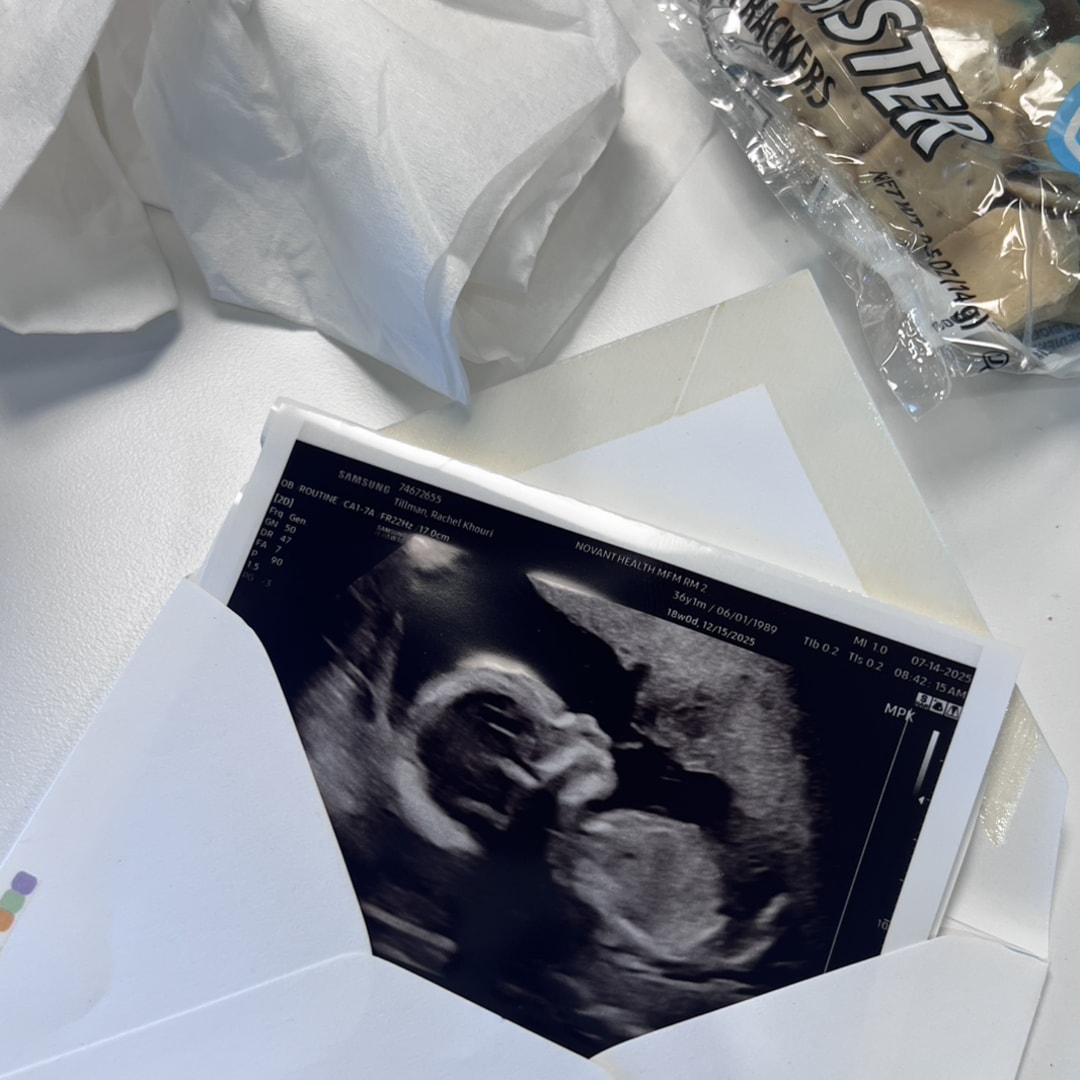 Photo shared by Rachel for their Babylist baby registry.