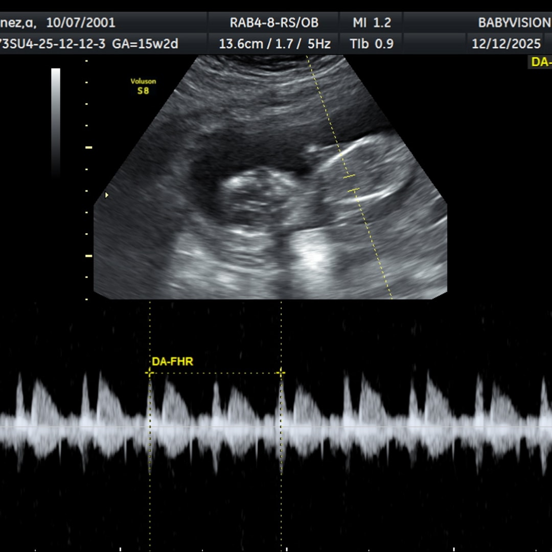 Photo shared by Angelina for their Babylist baby registry.