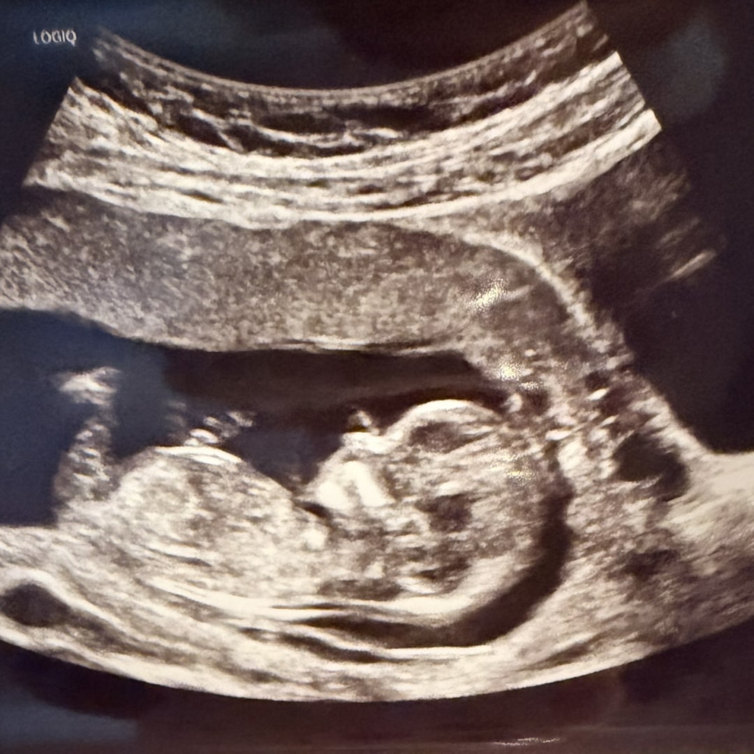 Photo shared by Devan for their Babylist baby registry.