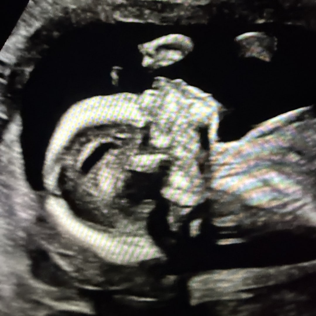 Photo shared by Allison for their Babylist baby registry.