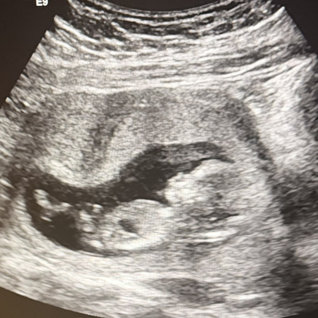Photo shared by Veronica for their Babylist baby registry.