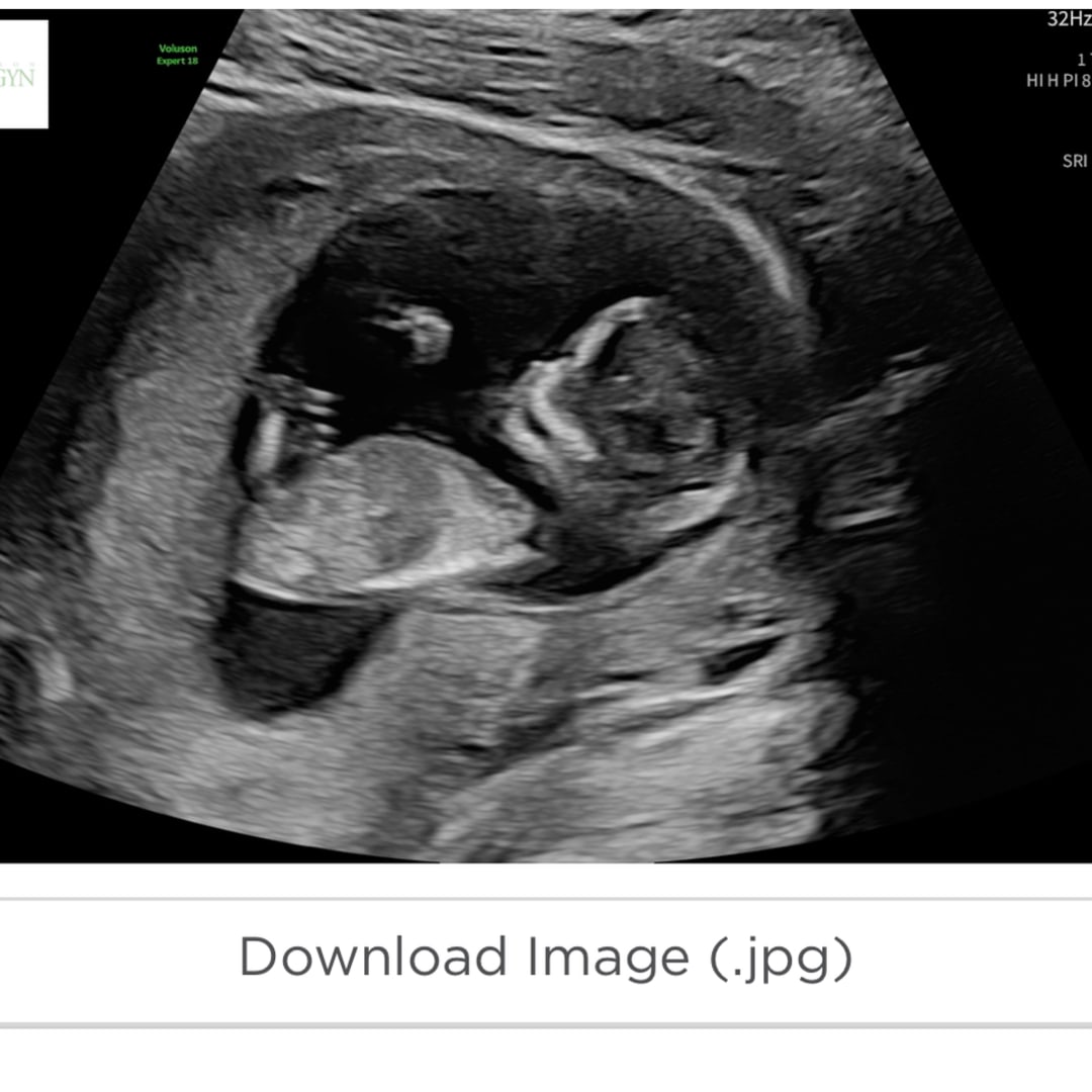 Photo shared by Maricar for their Babylist baby registry.