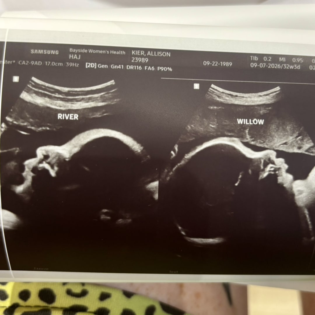 Photo shared by Allison for their Babylist baby registry.
