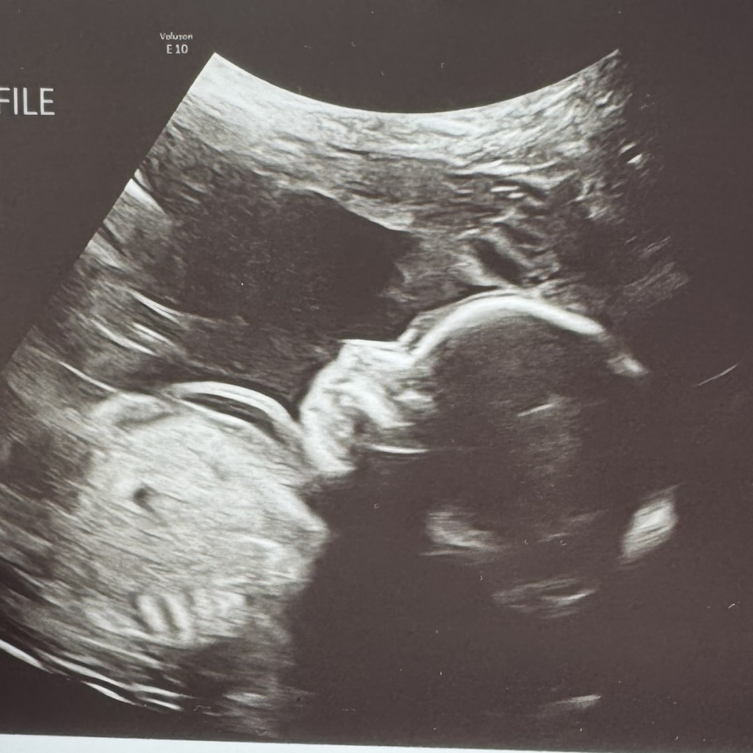 Photo shared by Jessie for their Babylist baby registry.