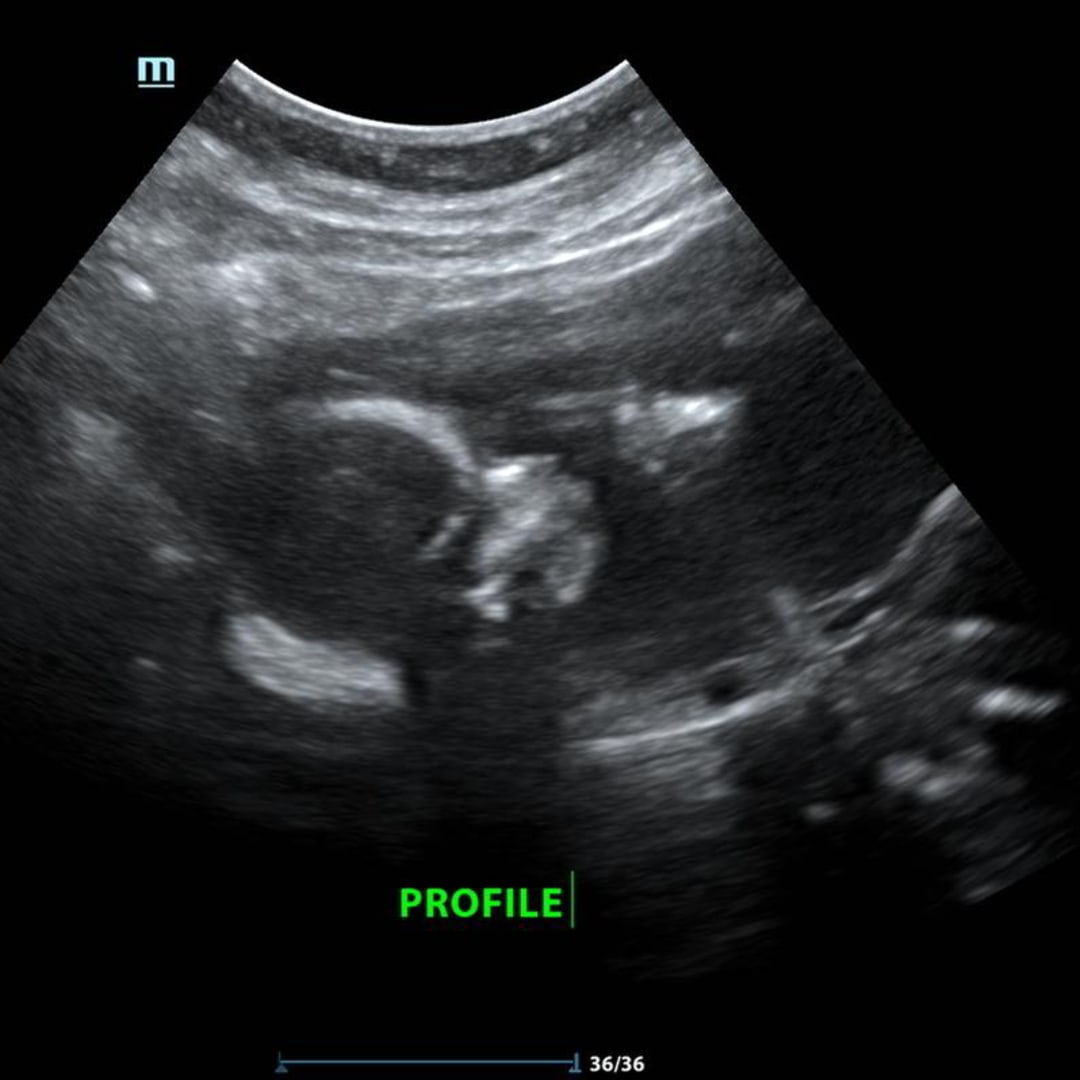 Photo shared by Gretel for their Babylist baby registry.