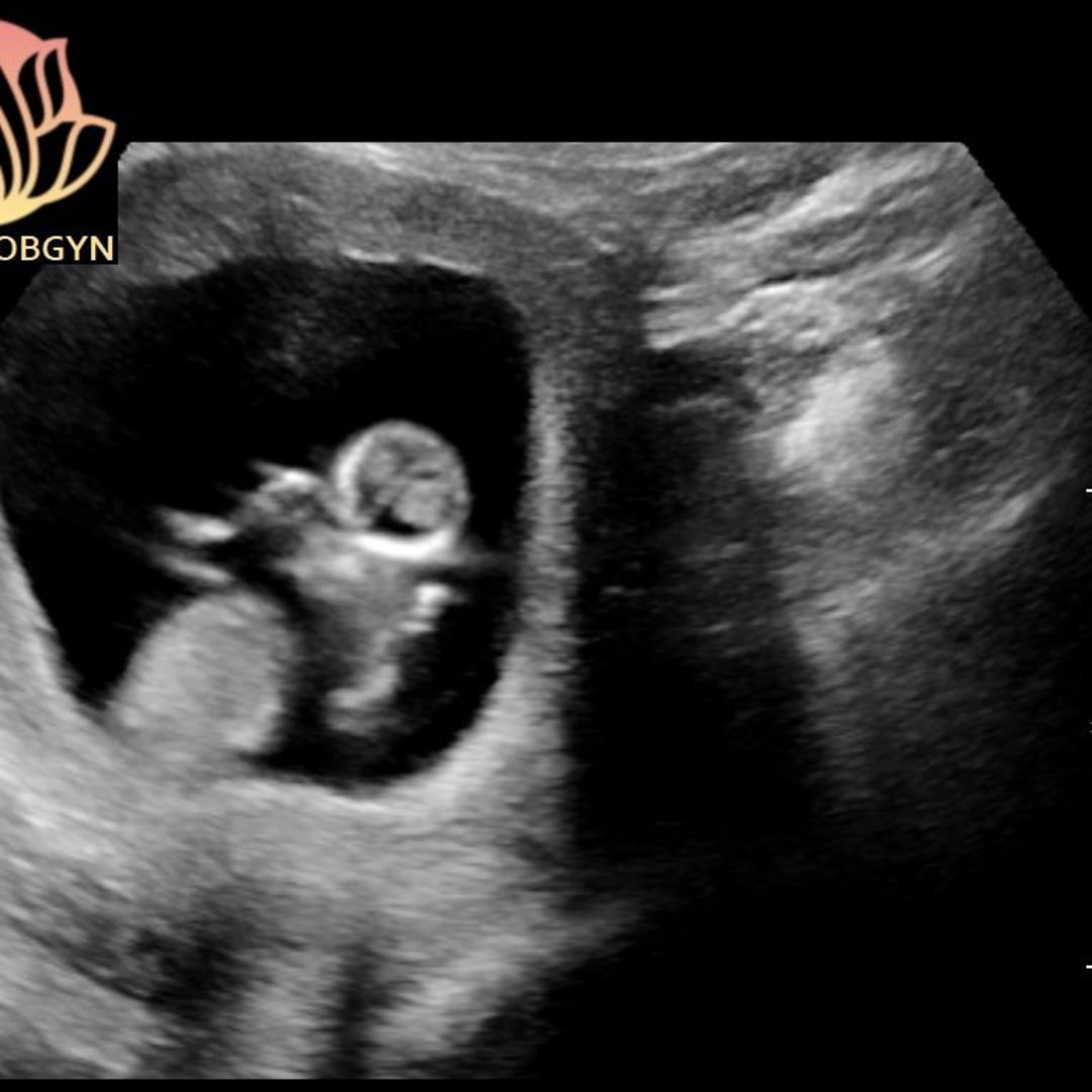 Photo shared by Casey for their Babylist baby registry.