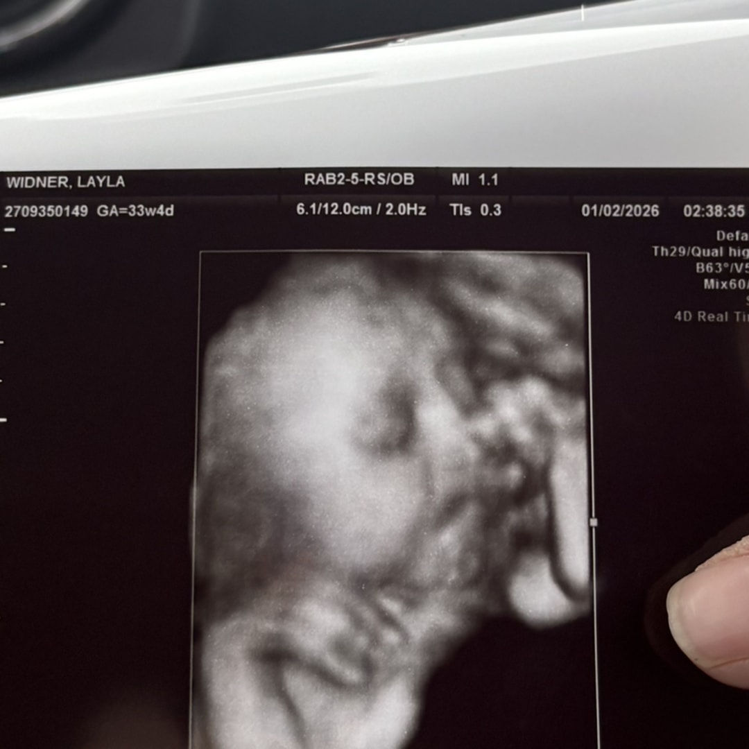 Photo shared by Layla for their Babylist baby registry.