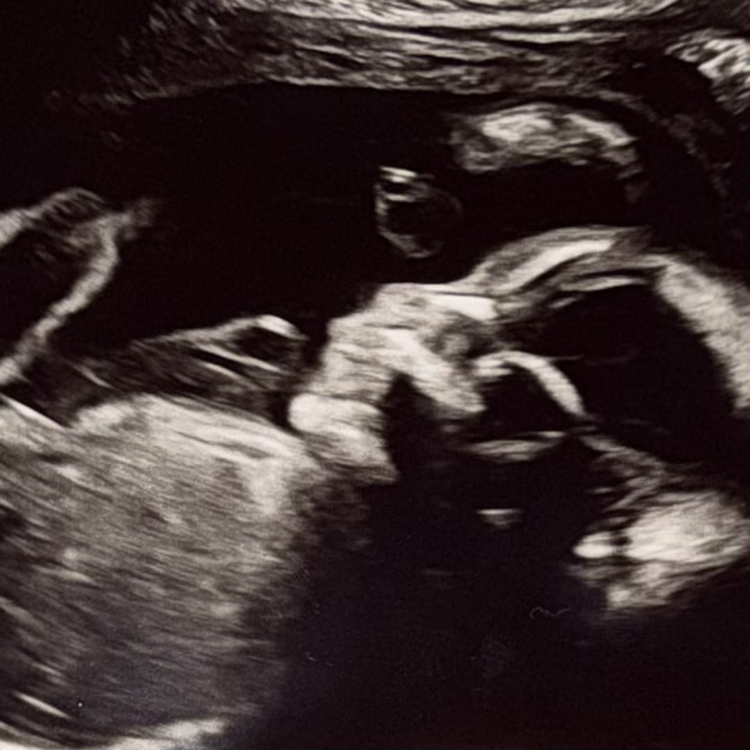 Photo shared by Kenley for their Babylist baby registry.