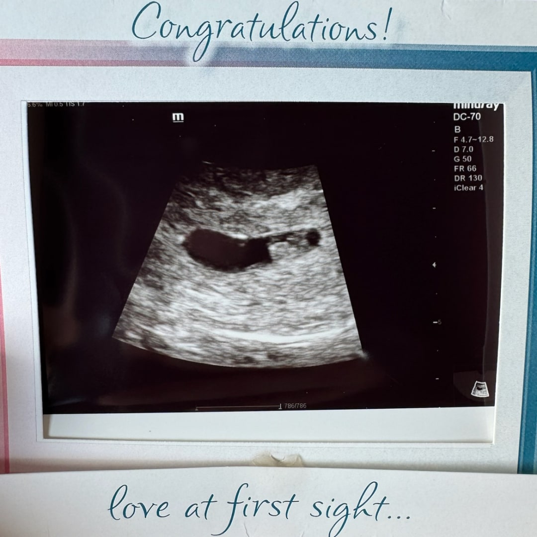 Photo shared by Autumn for their Babylist baby registry.