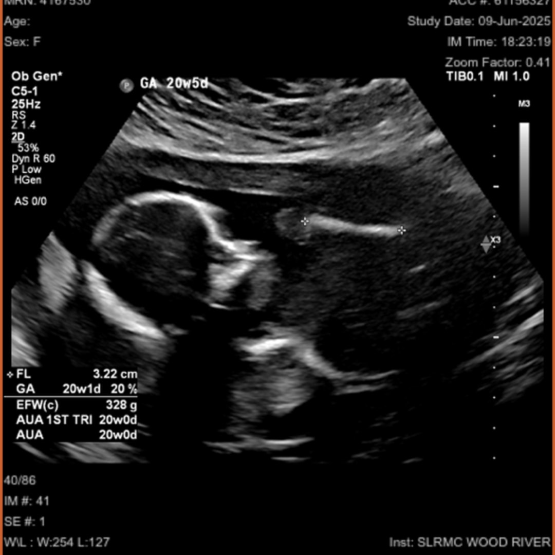 Photo shared by Emmersen for their Babylist baby registry.