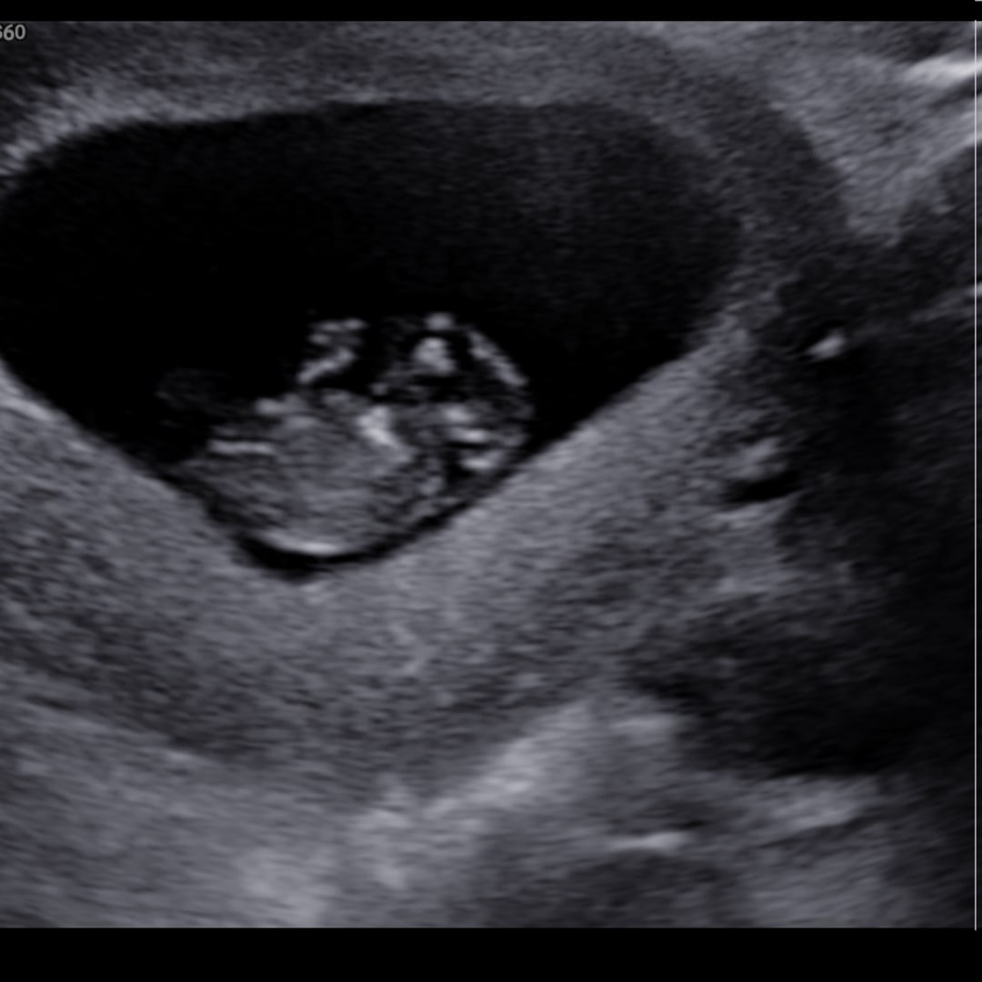 Photo shared by Ariany for their Babylist baby registry.