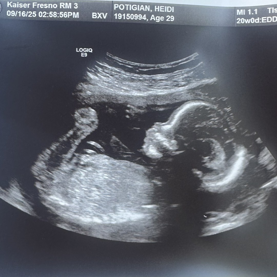 Photo shared by Heidi for their Babylist baby registry.