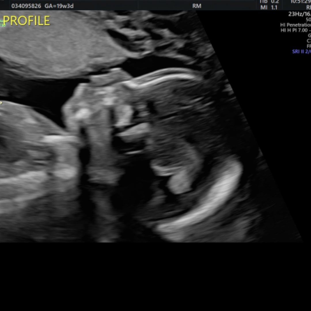 Photo shared by Aarielle for their Babylist baby registry.