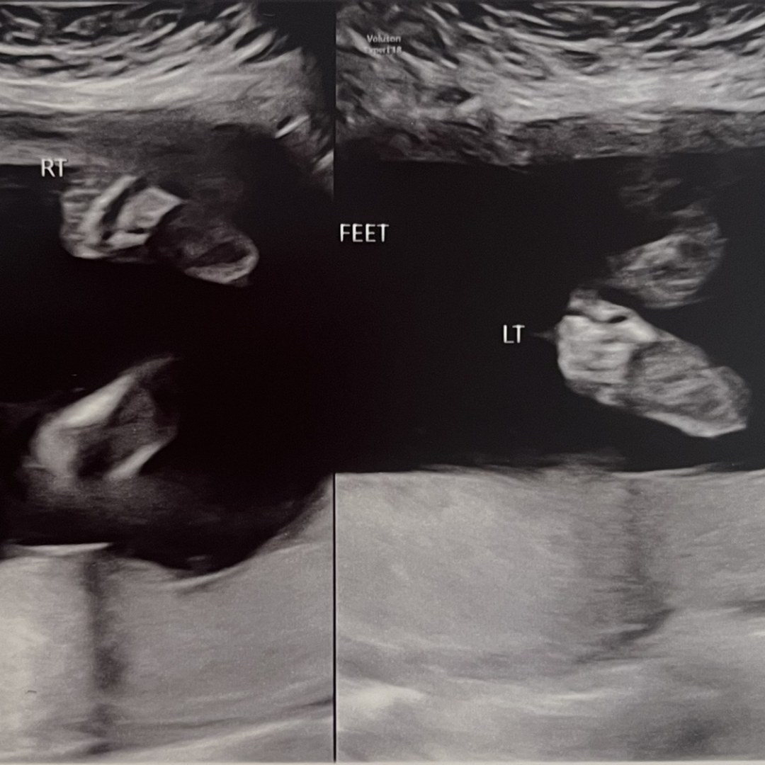 Photo shared by Paula for their Babylist baby registry.