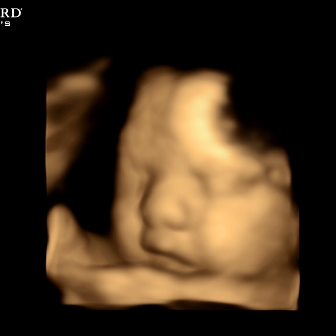 Photo shared by Hunter for their Babylist baby registry.
