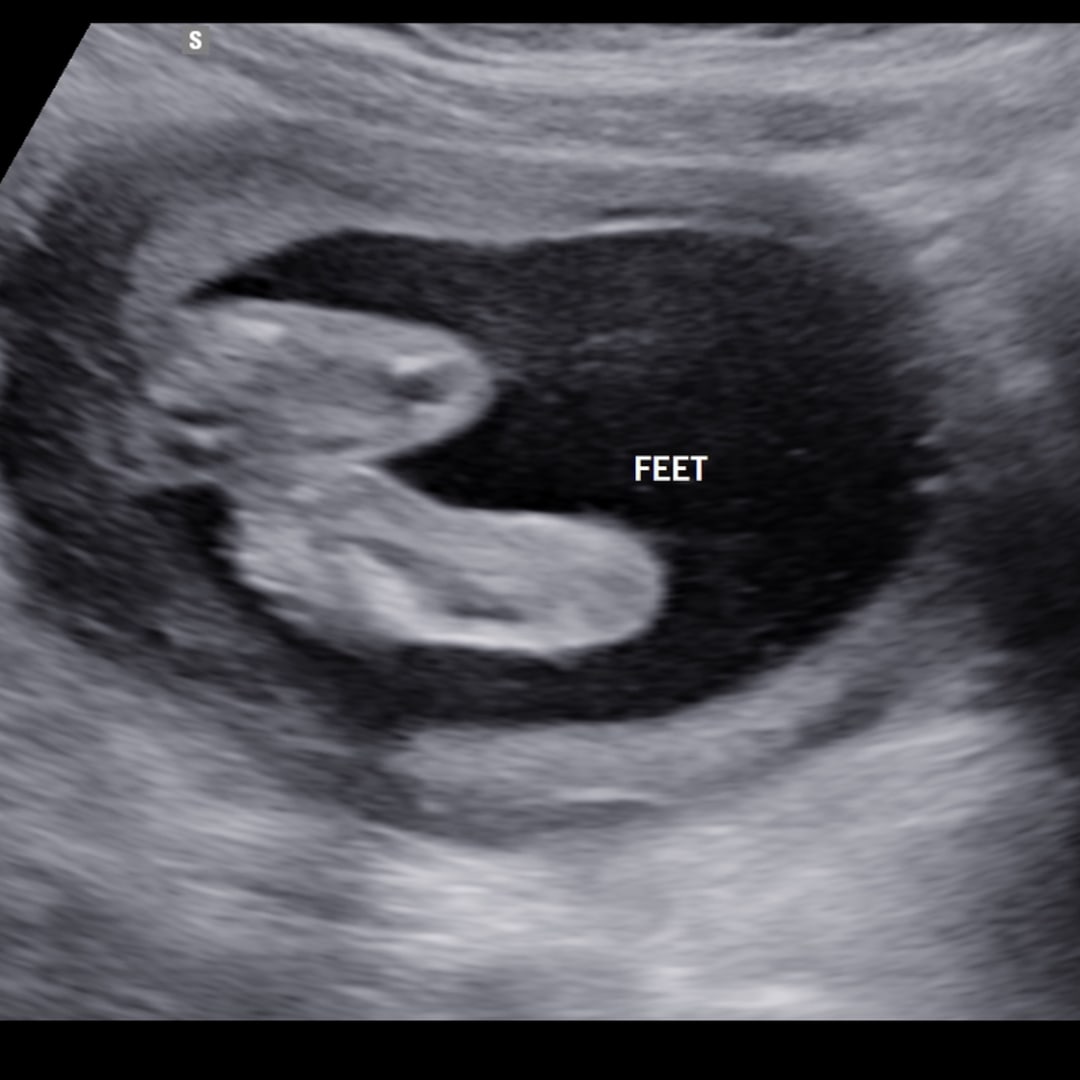 Photo shared by Destinee for their Babylist baby registry.