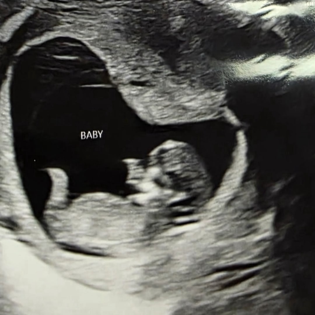 Photo shared by Jenna for their Babylist baby registry.