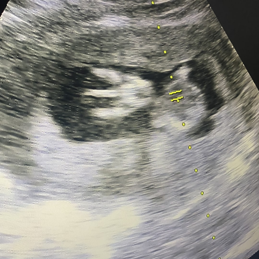 Photo shared by Jocelynn for their Babylist baby registry.