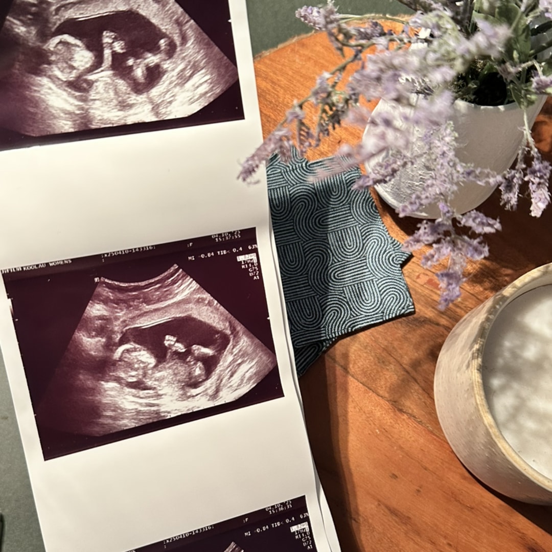 Photo shared by Kalena for their Babylist baby registry.