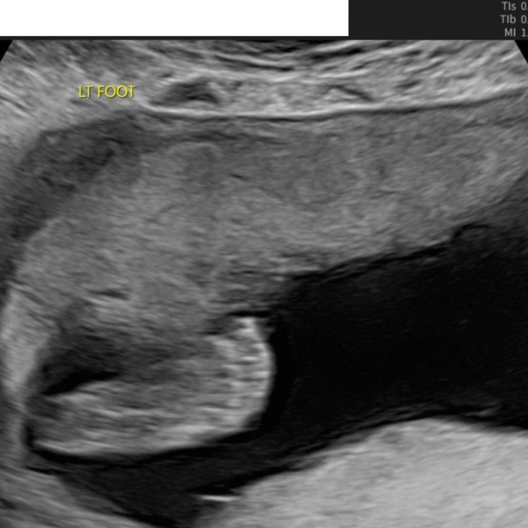 Photo shared by Gabbie for their Babylist baby registry.