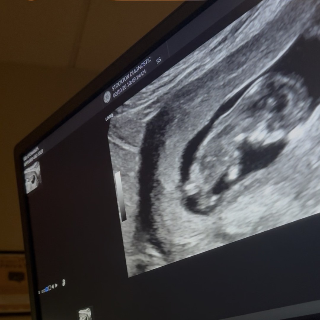 Photo shared by Sarah for their Babylist baby registry.
