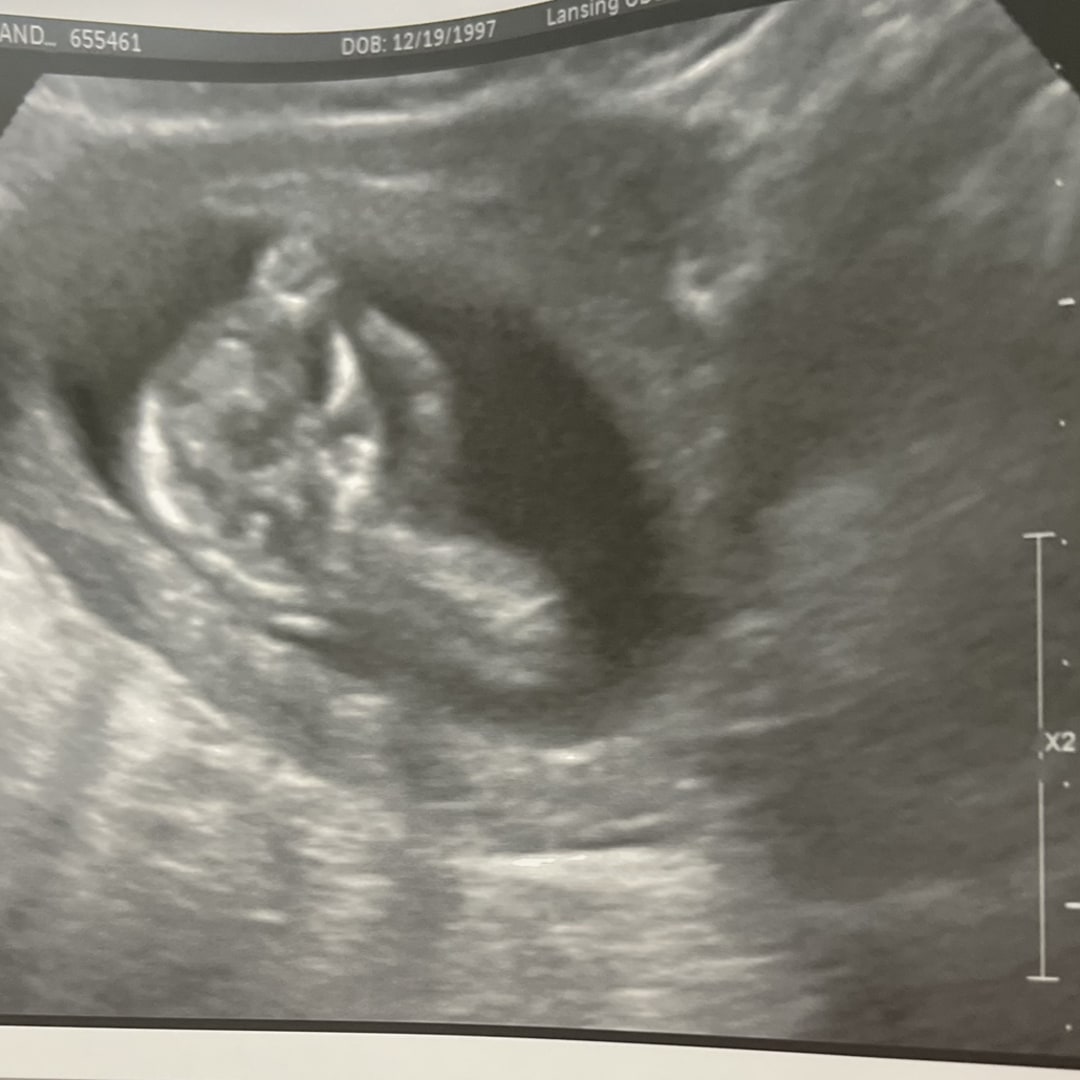 Photo shared by Ashanti for their Babylist baby registry.