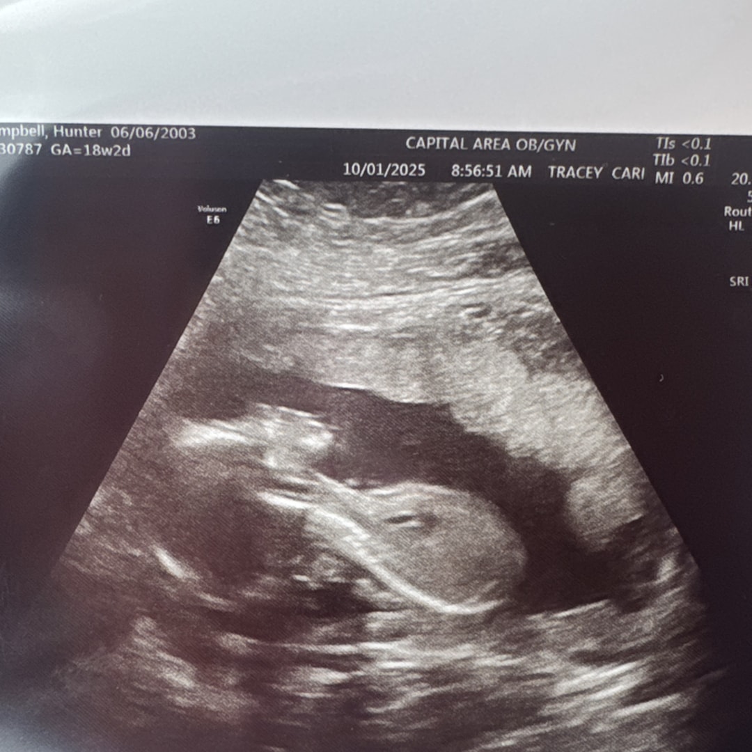 Photo shared by Hunter for their Babylist baby registry.