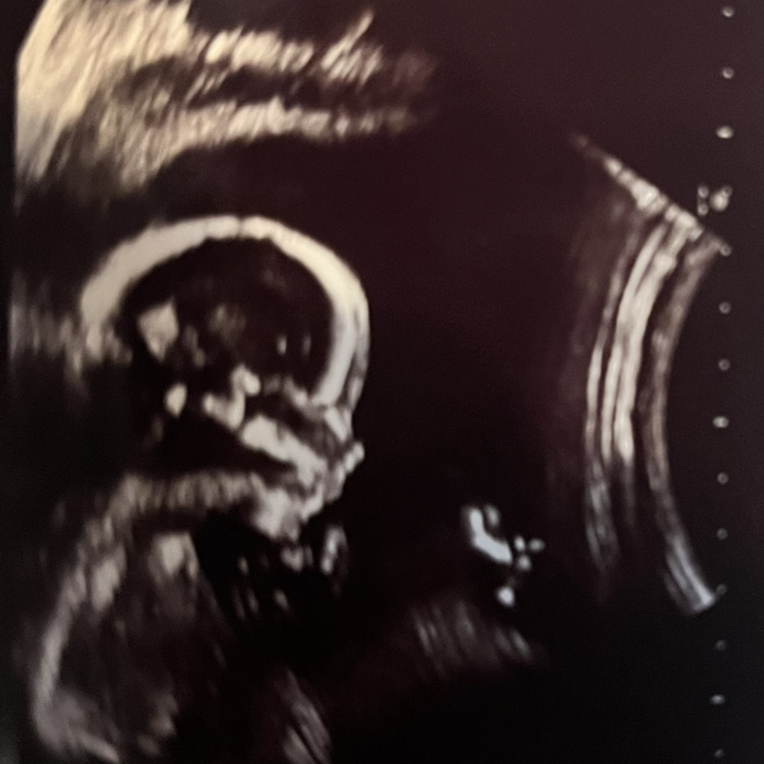 Photo shared by Kayla for their Babylist baby registry.