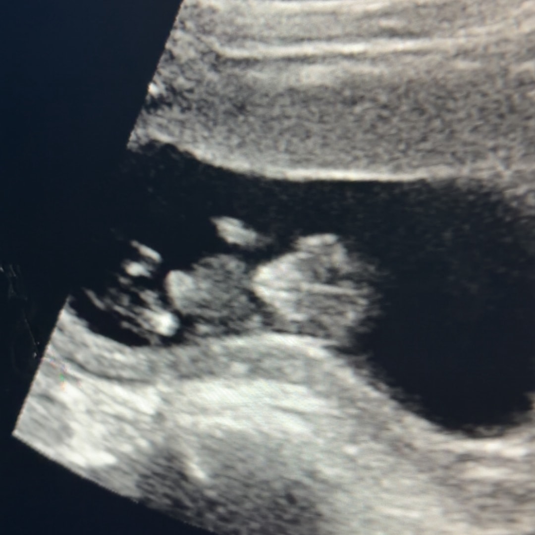 Photo shared by Daniella for their Babylist baby registry.