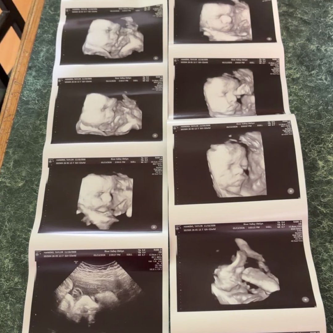 Photo shared by Taylor for their Babylist baby registry.