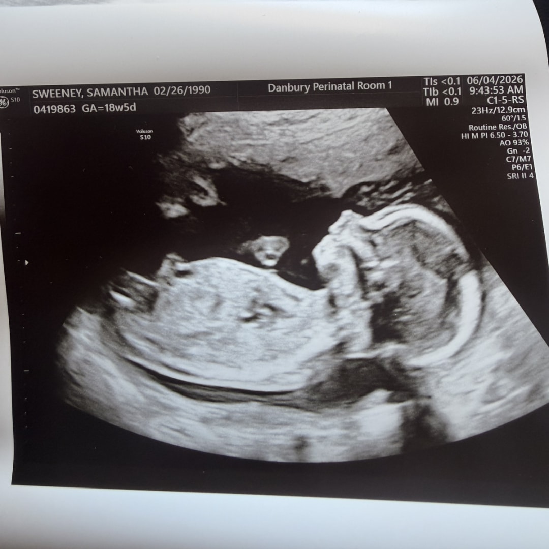 Photo shared by Samantha for their Babylist baby registry.