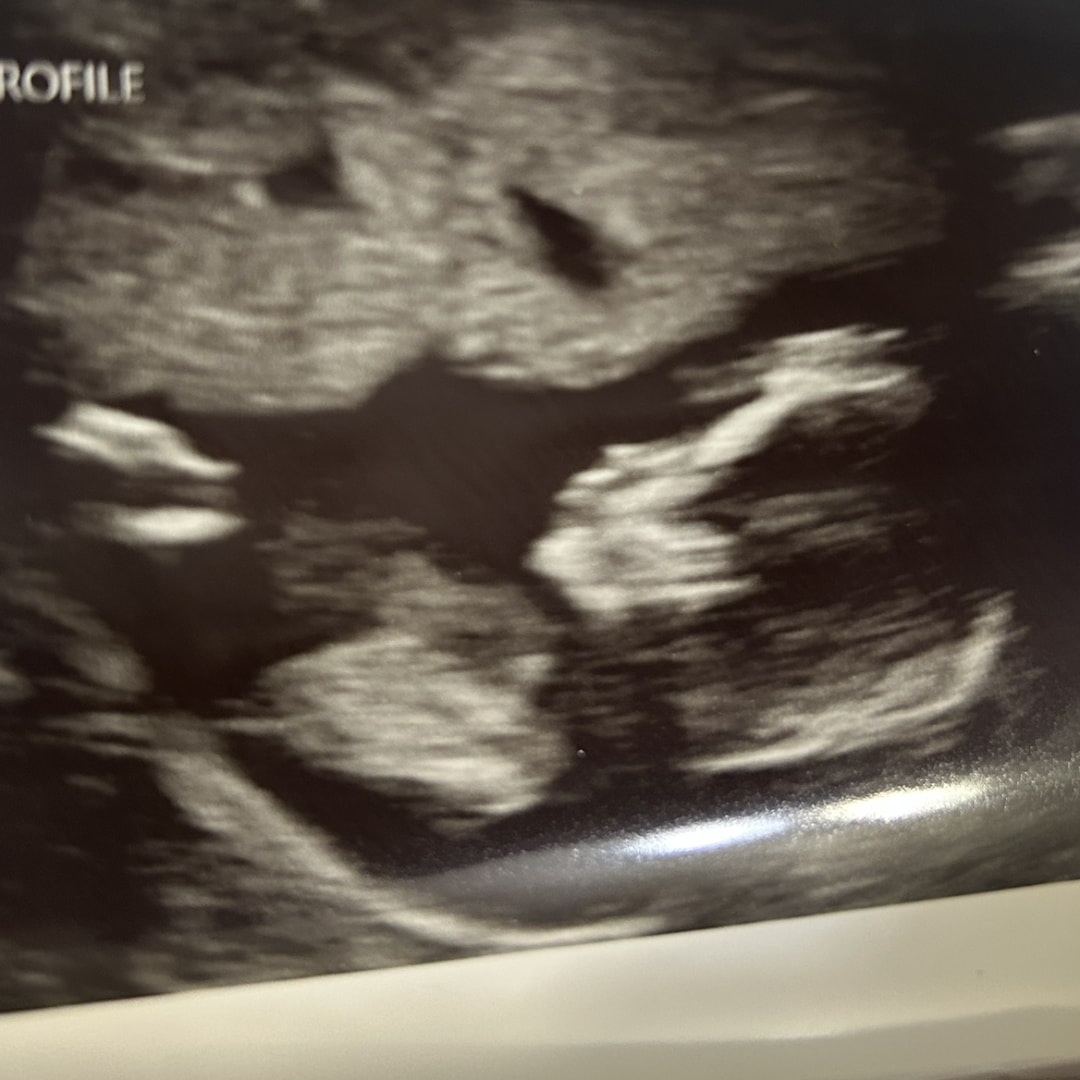 Photo shared by Devon for their Babylist baby registry.