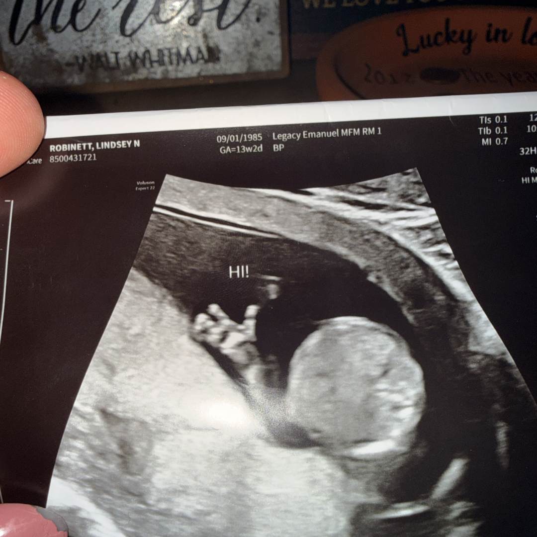 Photo shared by Lindsey for their Babylist baby registry.