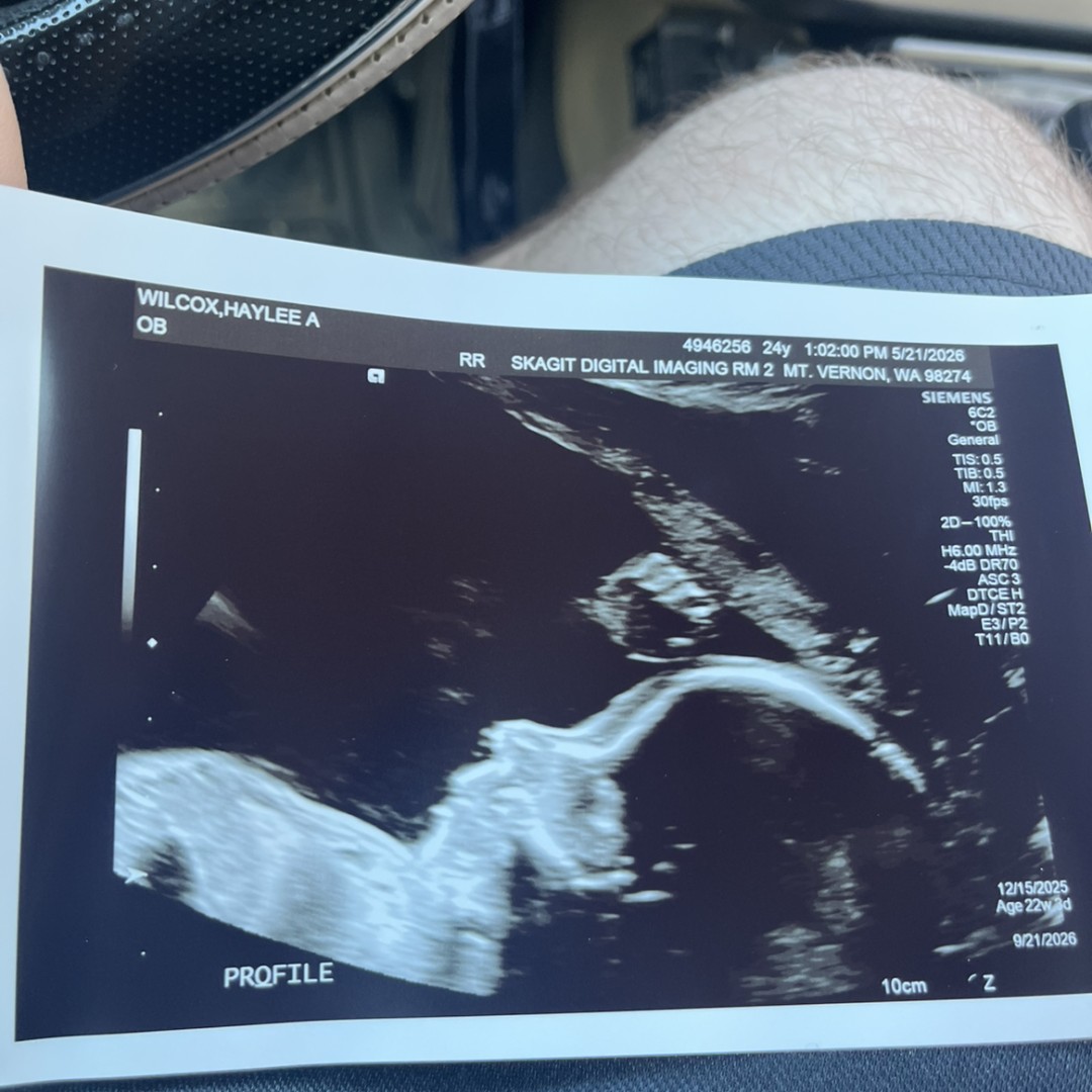 Photo shared by Haylee for their Babylist baby registry.