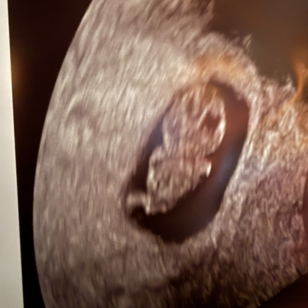 Photo shared by Ivy for their Babylist baby registry.