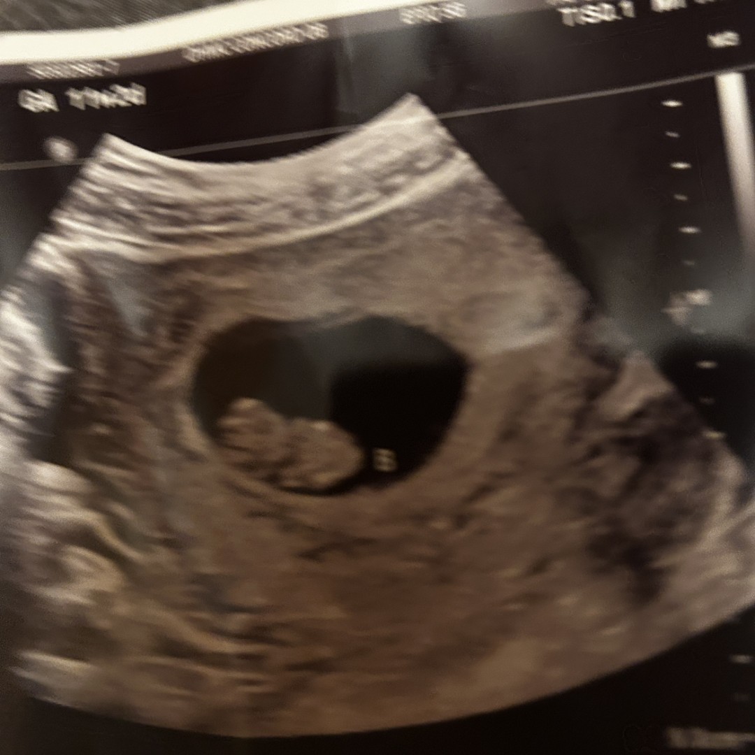 Photo shared by Jasmine for their Babylist baby registry.