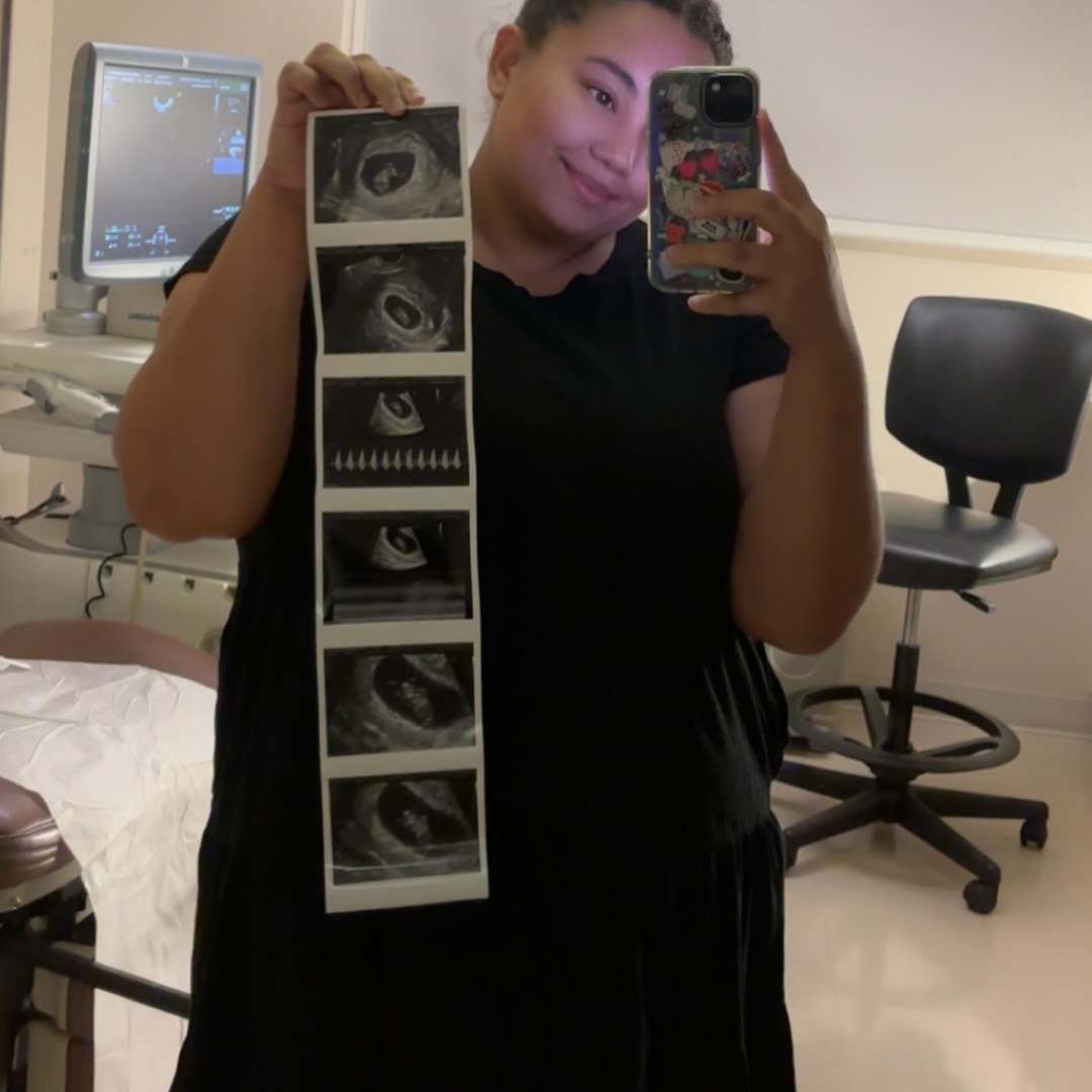 Photo shared by Alexis for their Babylist baby registry.