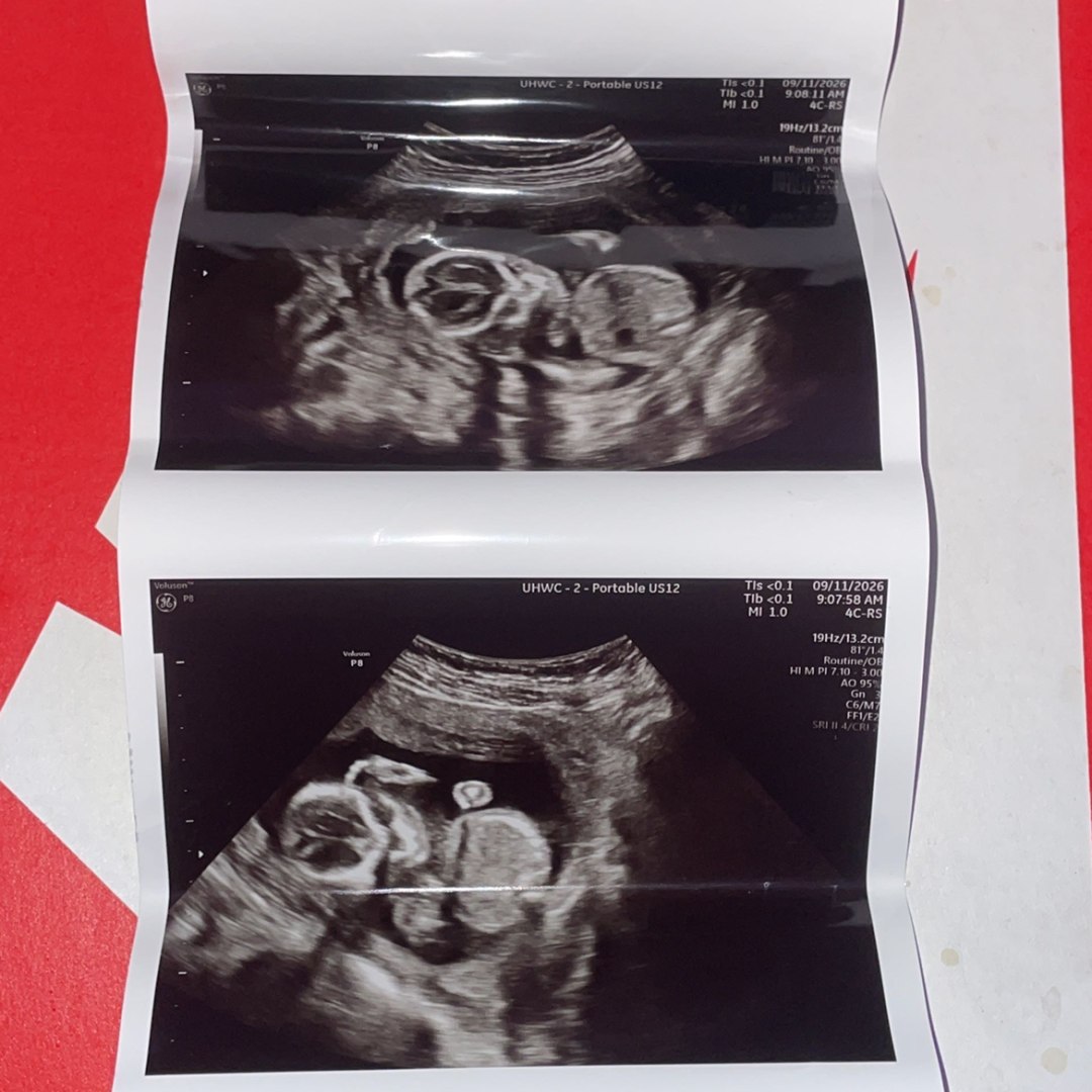 Photo shared by Emily for their Babylist baby registry.