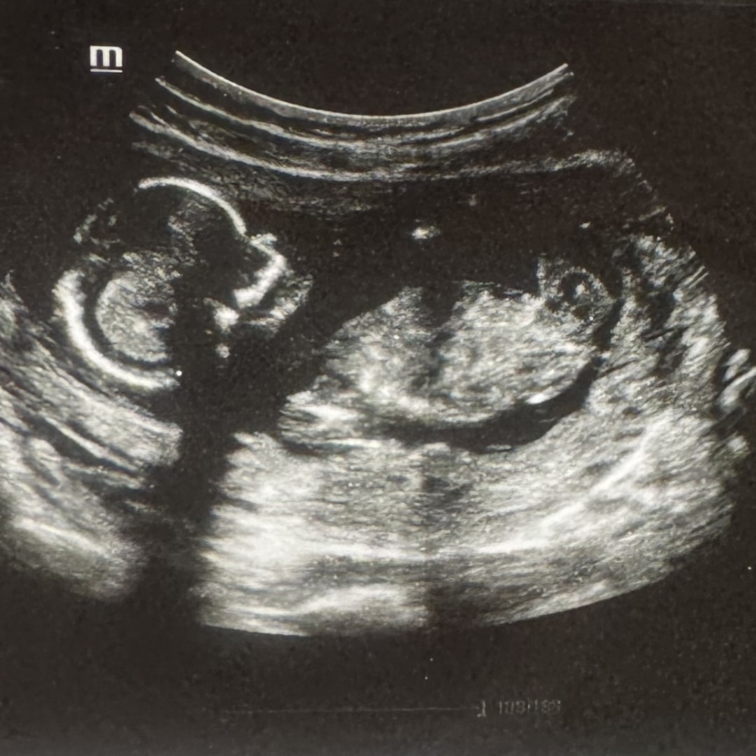 Photo shared by Marina for their Babylist baby registry.