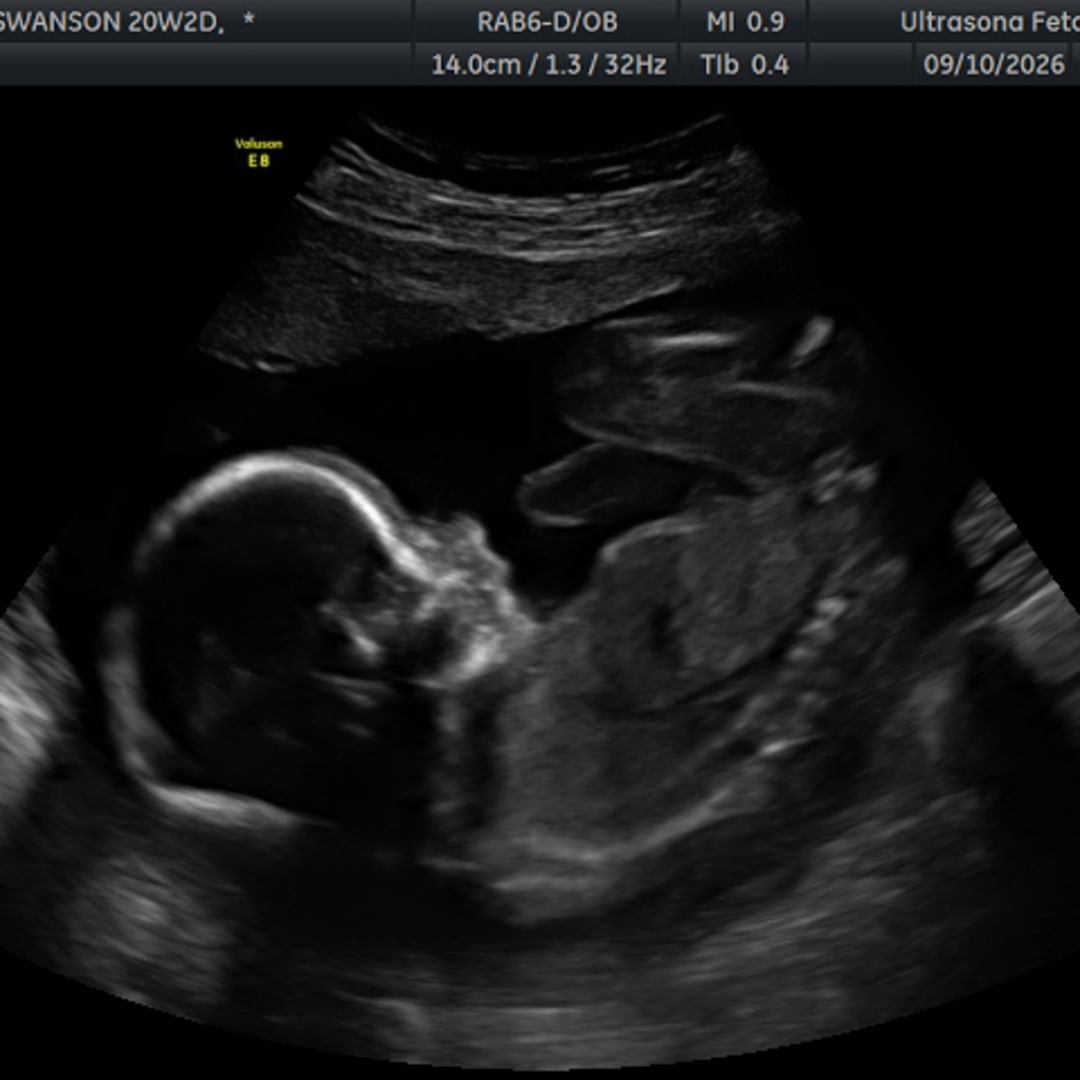 Photo shared by Erika for their Babylist baby registry.