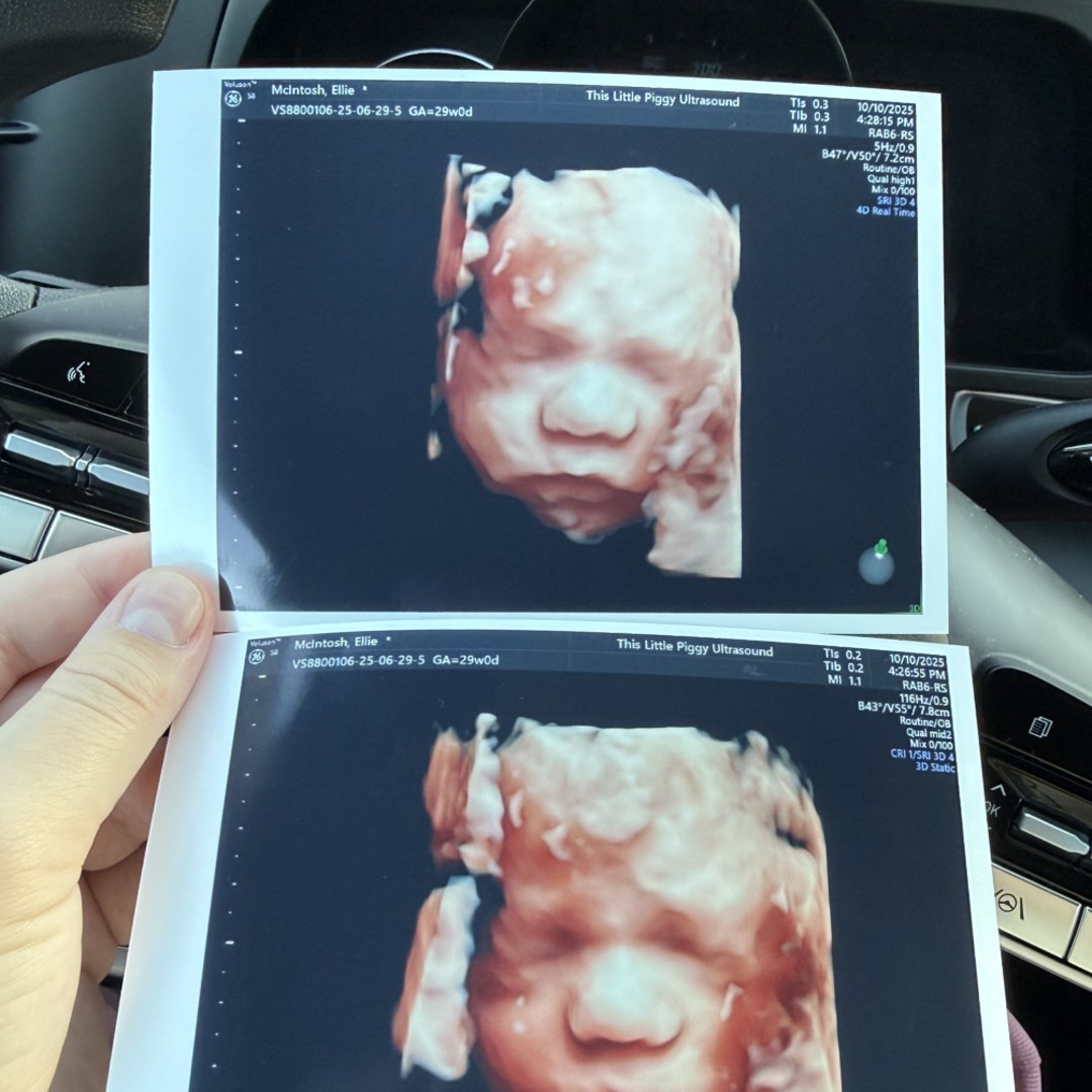 Photo shared by Ellie for their Babylist baby registry.