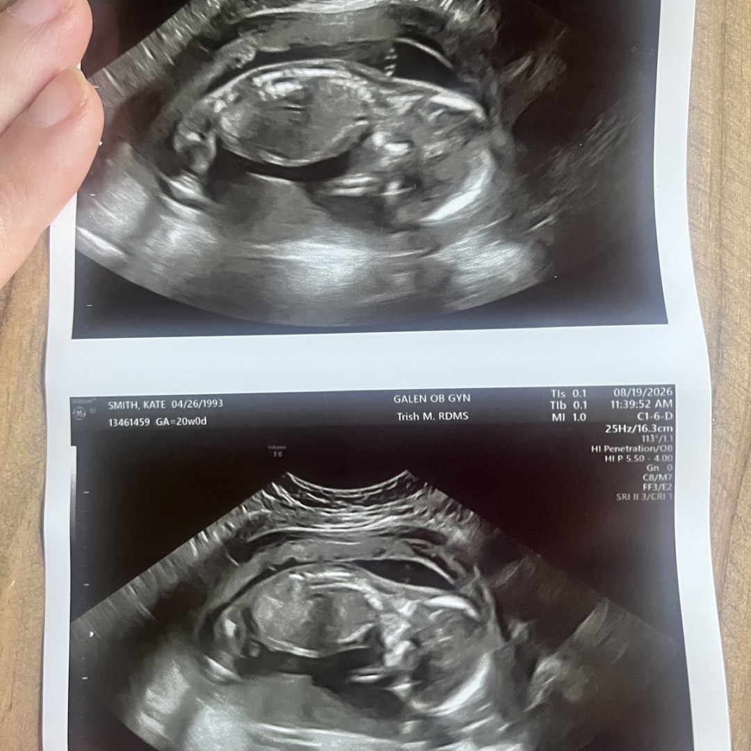 Photo shared by Kaitlyn for their Babylist baby registry.