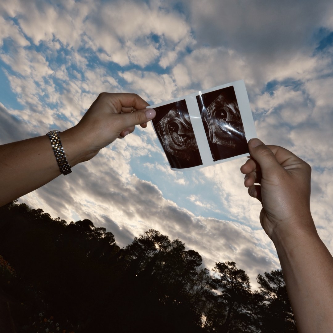 Photo shared by McKenzie for their Babylist baby registry.