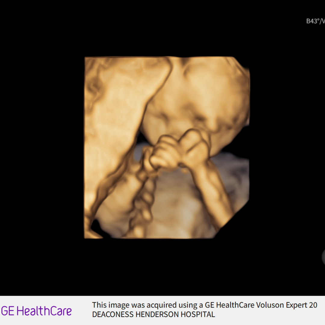 Photo shared by Brianna for their Babylist baby registry.