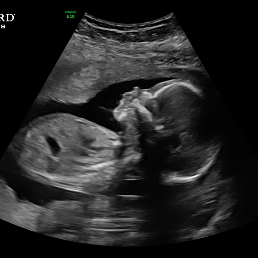 Photo shared by Kaydra for their Babylist baby registry.