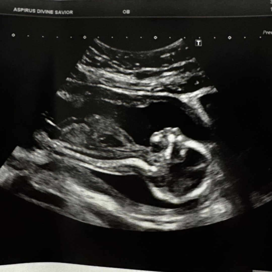 Photo shared by Carlie for their Babylist baby registry.