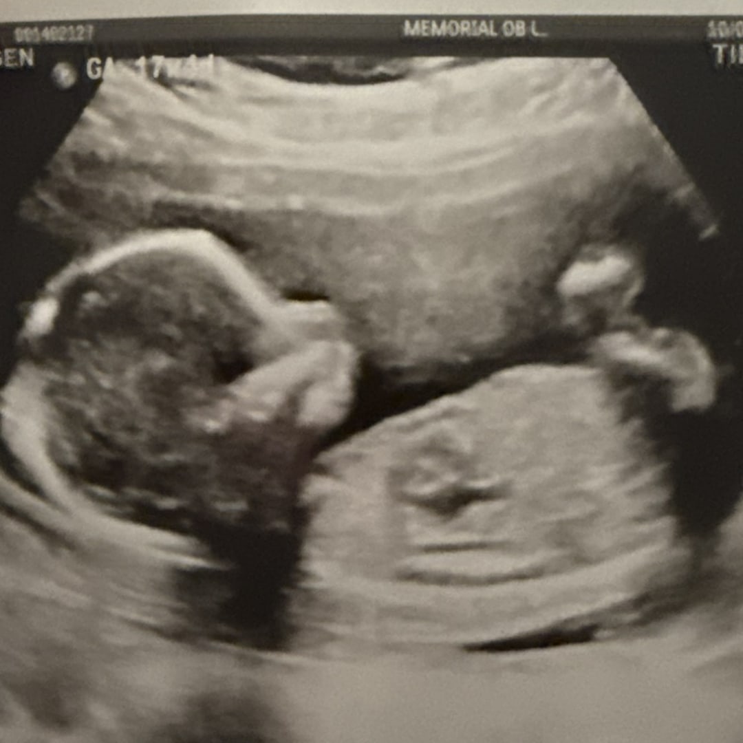 Photo shared by Colbie for their Babylist baby registry.