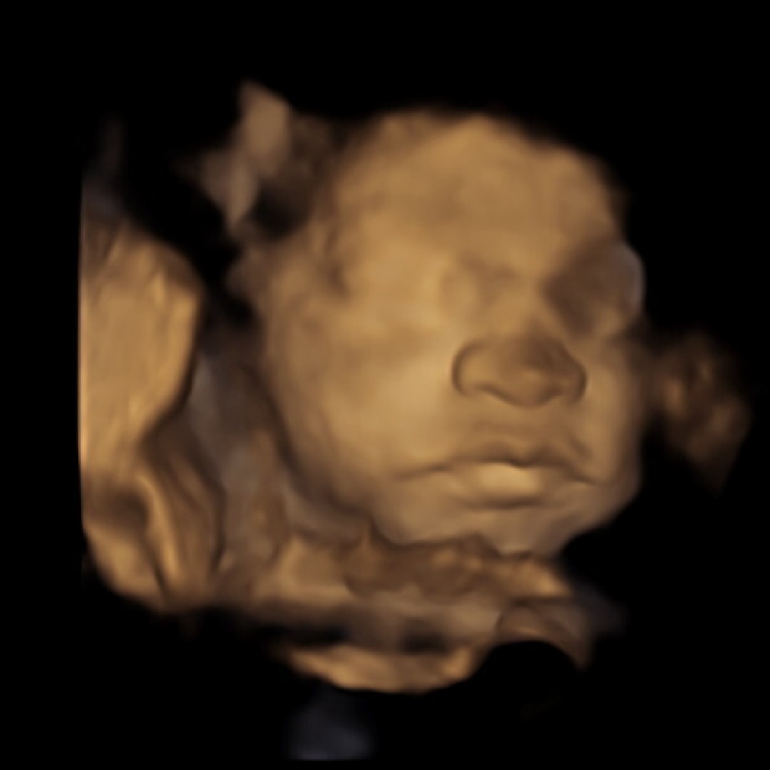 Photo shared by Nicole for their Babylist baby registry.