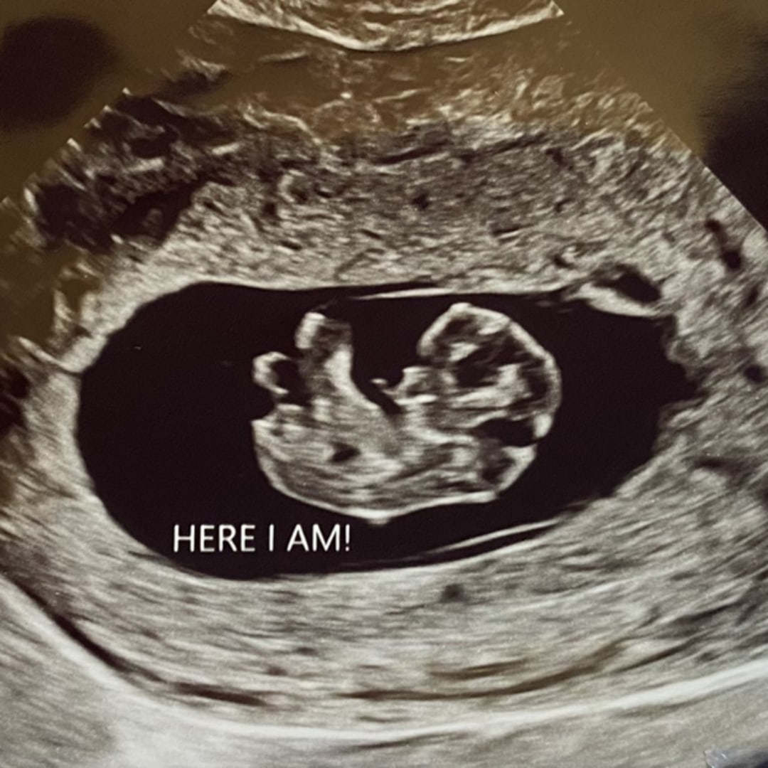 Photo shared by Eden for their Babylist baby registry.