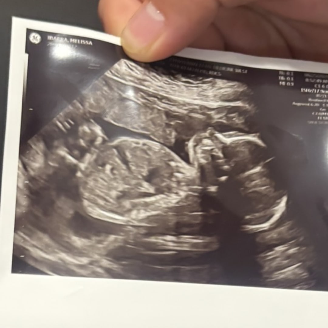 Photo shared by Melissa for their Babylist baby registry.